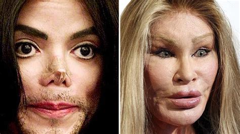 Top 5 Celebrity Plastic Surgery Disasters   YouTube
