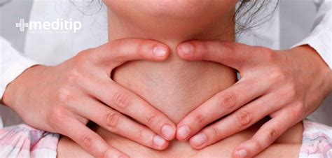 Tormenta tiroidea: definición, síntomas y tratamiento ...