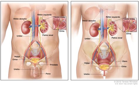 Tratamiento del cáncer de uretra  PDQ® —Versión para ...