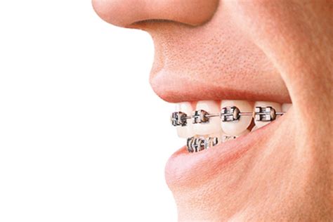 Tratamientos de odontología en Clínica Dental Torremolinos.