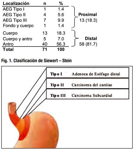 Tumor En El Estomago Related Keywords   Tumor En El ...