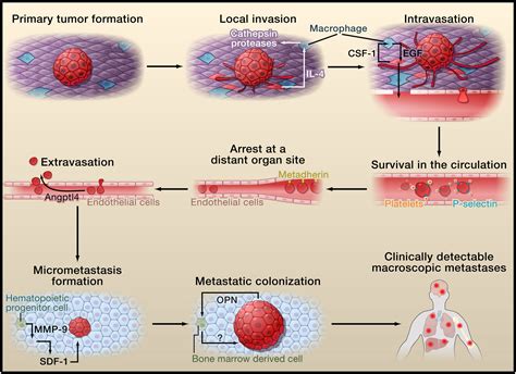 Tumor Metastasis: Molecular Insights and Evolving ...