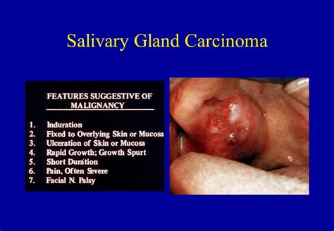 Tumors and Tumor like Lesions   ppt video online download