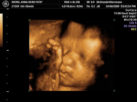 ultrasound 4d baby1 20090406 15 | Hank Word | Flickr