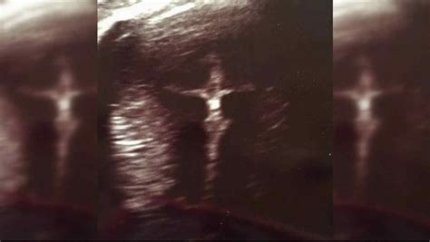 Ven a Jesús crucificado en sonograma de embarazada | Telemundo