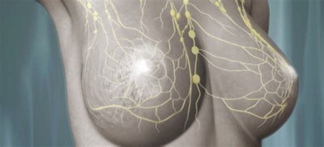 Vídeo 3D sobre el cáncer de mama para la AECC