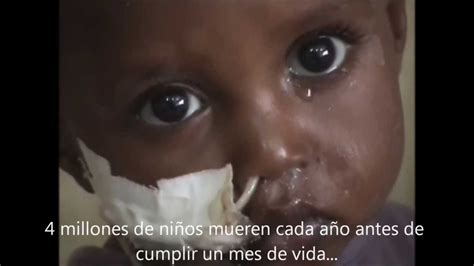 Vídeo niños desnutridos en Etiopía, África   YouTube