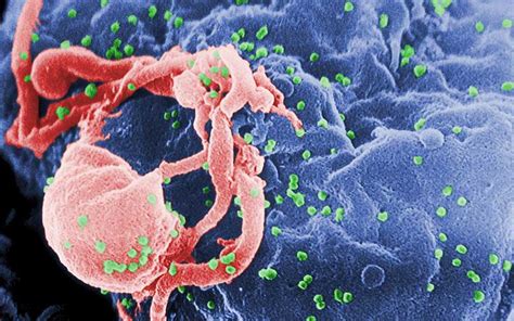 VIH/SIDA   Información y Características