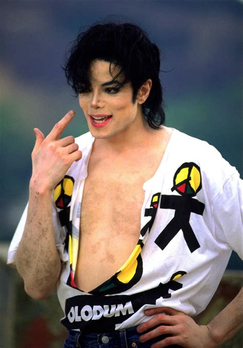 Vitiligo Is Very Apparent Here   Michael Jackson Photo ...