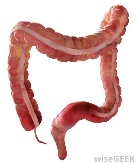What are Colon Parasites?  with pictures