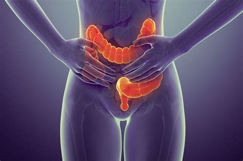 What Are The Early Symptoms And Signs of Colon Cancer?