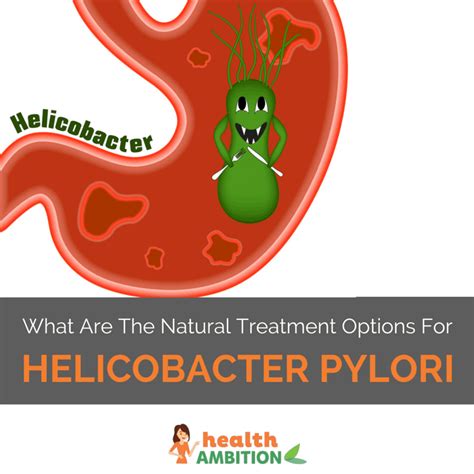What Are The H. Pylori Natural Treatment Options?   Health ...
