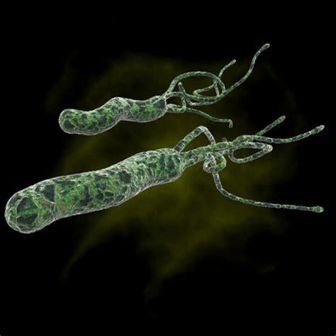What Causes H Pylori Infection... The Most Insidious ...