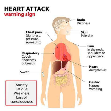 What Causes Heart Attacks—and How to Prevent Them ...