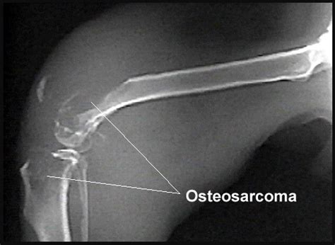 What Is Dog Osteosarcoma?