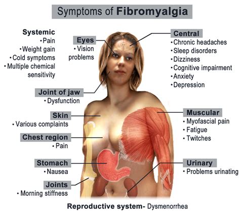What is Fibromyalgia? Symptoms, Diagnosis, & Treatment