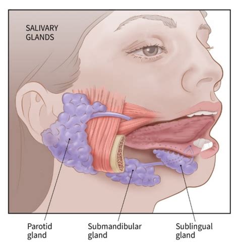 What Is Salivary Gland Cancer?