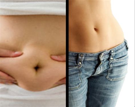 Why Your Lower Ab Flab Is the Last to Go: Belly Fat—A Big ...