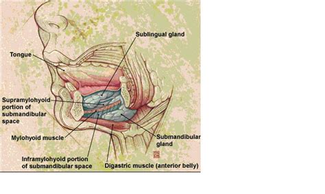 WizDent: Submandibular Space Infection