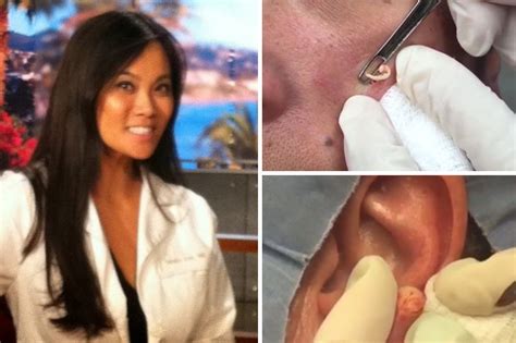 YouTube and Instagram star Dr Sandra Lee loves popping ...